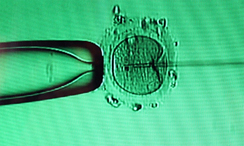 In-vitro-Infertilisation, Foto: Solis Invicti, flickr.com, CC BY 2.0